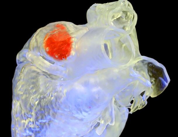 A specialized sono-ink hardens when exposed to focused ultrasound waves, transforming into biologically compatible structures, such as filling the atrial appendage in a model of a human heart. Credit: Junjie Yao, Duke University; Y. Shrike Zhang, Brigham and Women’s Hospital and Harvard Medical School